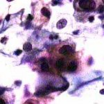 Δοκιμασία οξικού οξέως